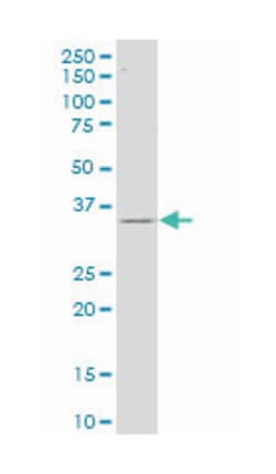 capping protein (actin filament) muscle Z-line, alpha 2, Mouse, Polyclonal Antibody, Abnova&trade;