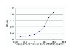 CASR, Mouse, Clone: 3F12, Abnova 100 &mu;g | Buy Online | Abnova Corporation | Fisher Scientific