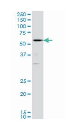 runt-related transcription factor 2, Mouse, Clone: 4D5, Abnova 100&mu;g;
