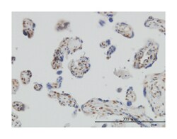 RUNX2, Mouse, Clone: 1D2, Abnova 100 &mu;g | Buy Online | Abnova | Fisher Scientific