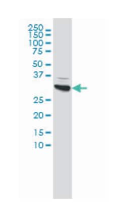 carbonyl reductase 1, Mouse, Clone: 4D12-1G8, Abnova 100&mu;g; Unlabeled:Antibodies,