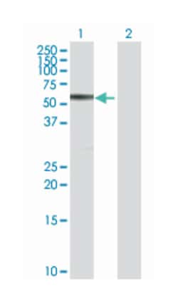 cystathionine-beta-synthase, Rabbit, Purified MaxPab™ Polyclonal Antibody, Abnova™