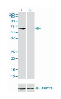 CBS, Mouse, Clone: 3E1, Abnova 100&mu;g; Unlabeled:Antibodies, Monoclonal