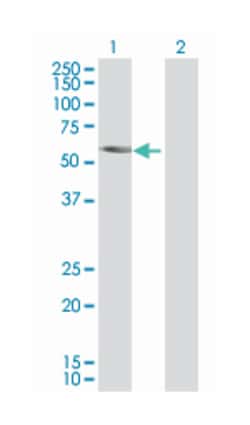 cyclin E1, Mouse, Polyclonal Antibody, Abnova 50 &mu;L | Buy Online | Abnova | Fisher Scientific