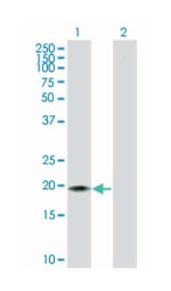 CD3d molecule, delta (CD3-TCR complex), Mouse, Polyclonal Antibody, Abnova