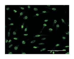 CDR2, Mouse, Clone: 4D2, Abnova 100&mu;g; Unlabeled:Anticuerpos