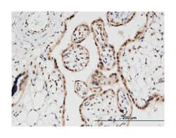 PRPH, Mouse, Clone: 3B3, Abnova 100&mu;g; Unlabeled:Antibodies, Monoclonal
