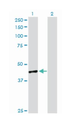 twinfilin, actin-binding protein, homolog 1 (Drosophila), Rabbit, Purified