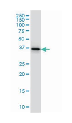 twinfilin, actin-binding protein, homolog 1 (Drosophila), Mouse, Clone: