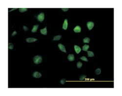 RAP1, GTP-GDP dissociation stimulator 1, Mouse, Purified MaxPab Polyclonal