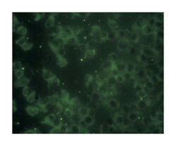 RAP2B, Mouse, Clone: 4F12-3C6, Abnova 100&mu;g; Unlabeled:Antibodies, Monoclonal