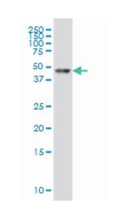 retinoic acid receptor, alpha, Mouse, Clone: 2D2, Abnova 100&mu;g; Unlabeled:Antibodies,