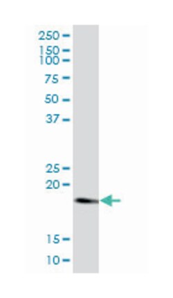 Ras homolog enriched in brain, Mouse, Polyclonal Antibody, Abnova 50&mu;L;