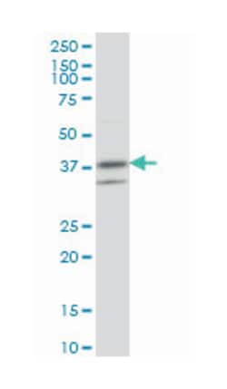 ring finger protein 2, Mouse, Clone: 6C2, Abnova 100 &mu;g | Buy Online | Abnova Corporation | Fisher Scientific