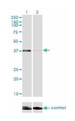 ring finger protein 2, Mouse, Clone: 6C2, Abnova 100 &mu;g | Buy Online | Abnova Corporation | Fisher Scientific