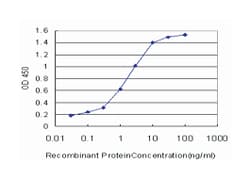 ring finger protein 2, Mouse, Clone: 6C2, Abnova 100 &mu;g | Buy Online | Abnova Corporation | Fisher Scientific