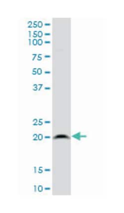 ribosomal protein L21, Mouse, Polyclonal Antibody, Abnova 50&mu;L; Unlabeled:Antibodies,