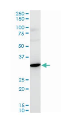 ribosomal protein S3A, Mouse, Polyclonal Antibody, Abnova 50μL; Unlabeled:Antibodies,