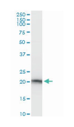 SAT, Mouse, Polyclonal Antibody, Abnova 50&mu;L; Unlabeled:Antibodies,