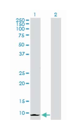 chemokine (C-X-C motif) ligand 6 (granulocyte chemotactic protein 2), Rabbit,