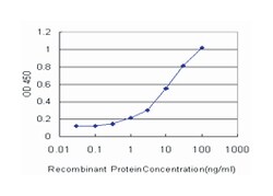 solute carrier family 1 (glial high affinity glutamate transporter), member