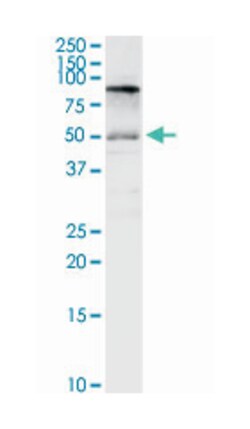 solute carrier family 3 (activators of dibasic and neutral amino acid transport),
