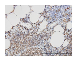 sphingomyelin phosphodiesterase 2, neutral membrane (neutral sphingomyelinase),