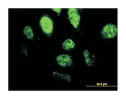 spleen focus forming virus (SFFV) proviral integration oncogene spi1, Mouse,