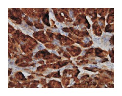 serine peptidase inhibitor, Kazal type 1, Mouse, Clone: 4D4, Abnova 100&mu;g;