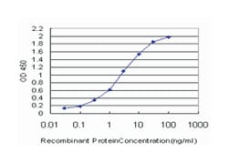serum response factor (c-fos serum response element-binding transcription