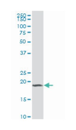 t-complex-associated-testis-expressed 3, Mouse, Polyclonal Antibody, Abnova