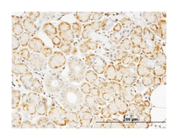 tumor necrosis factor (TNF superfamily, member 2), Mouse, Clone: M1-C4,