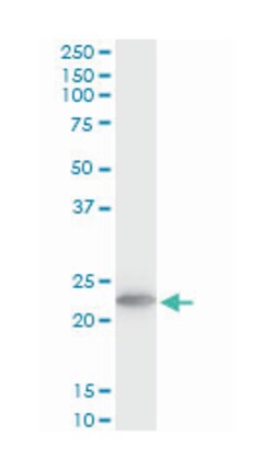 tumor protein, translationally-controlled 1, Mouse, Clone: 2C4, Abnova