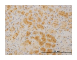 tetratricopeptide repeat domain 1, Mouse, Clone: 4E3, Abnova&trade;