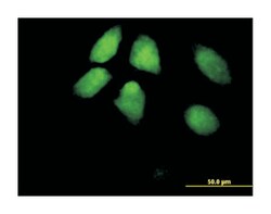 HIR histone cell cycle regulation defective homolog A (S. cerevisiae),