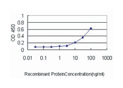 UCHL1, Mouse, Clone: 1B8-4D2, Abnova 100 &mu;g | Buy Online | Abnova Corporation | Fisher Scientific
