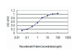 transient receptor potential cation channel, subfamily V, member 1, Mouse,