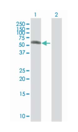 zinc finger protein 19, Mouse, Polyclonal Antibody, Abnova 50&mu;L; Unlabeled:Antibodies,