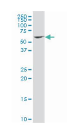 zinc finger protein 37A (A01), Mouse anti-Human, Polyclonal Antibody, Abnova 50 &mu;L | Buy Online | Abnova Corporation | Fisher Scientific