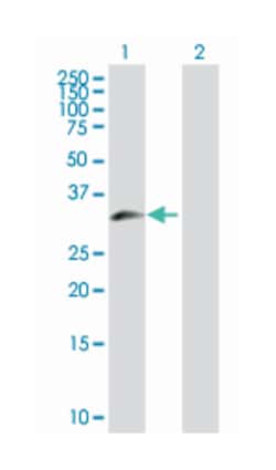 zinc finger protein 215, Rabbit, Purified MaxPab Polyclonal Antibody, Abnova