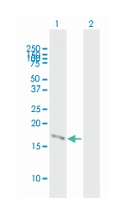 prostate stem cell antigen, Mouse, Polyclonal Antibody, Abnova&trade;
