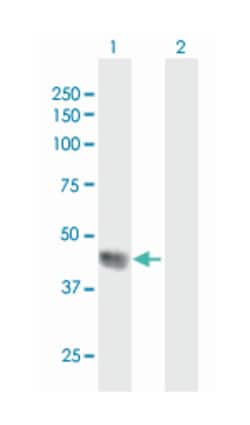 speckle-type POZ protein, Mouse, Purified MaxPab™ Polyclonal Antibody, Abnova™