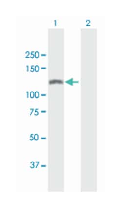 SWI/SNF related, matrix associated, actin dependent regulator of chromatin, subfamily a, member 5 (B01), Mouse anti-Human, Polyclonal Antibody, Abnova&trade;