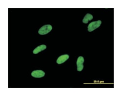SWI/SNF related, matrix associated, actin dependent regulator of chromatin, subfamily a, member 5 (B01), Mouse anti-Human, Polyclonal Antibody, Abnova&trade;