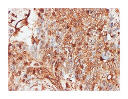 protein kinase, interferon-inducible double stranded RNA dependent activator,