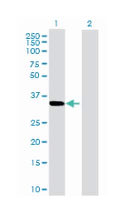 carbonyl reductase 3 (B01), Mouse anti-Human, Polyclonal Antibody, Abnova