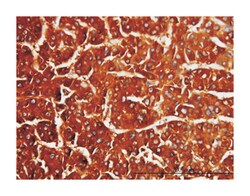 CBS, Mouse, Clone: 3E1, Abnova 100&mu;g; Unlabeled:Antibodies, Monoclonal