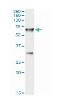 CBS, Mouse, Clone: 3D10, Abnova 100 &mu;g | Buy Online | Abnova Corporation | Fisher Scientific