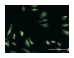 CBS, Mouse, Clone: 3D10, Abnova 100 &mu;g | Buy Online | Abnova Corporation | Fisher Scientific
