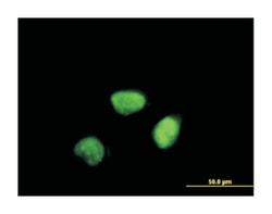 cyclin A2, Mouse, Polyclonal Antibody, Abnova 50&mu;L; Unlabeled:Antibodies,